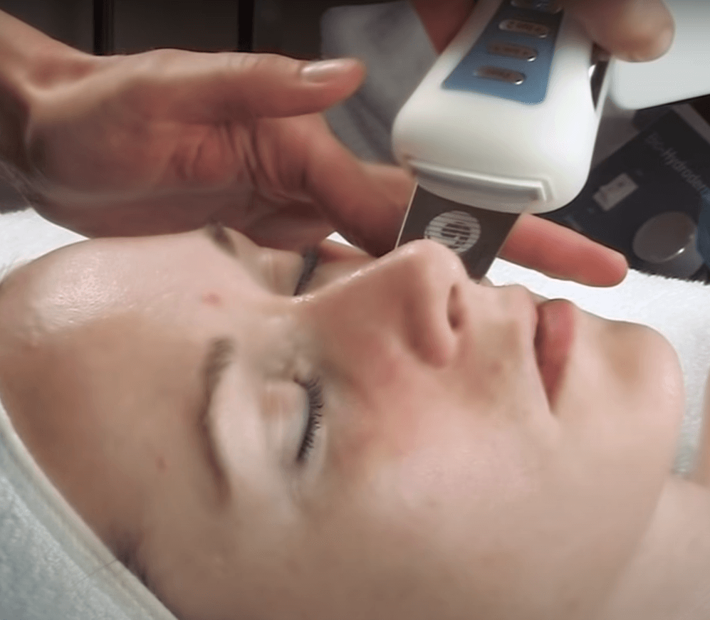 bt-micro fusion pro exfoliation system